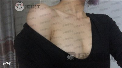 杭州艺星,万连壮,隆胸,案例,价格,