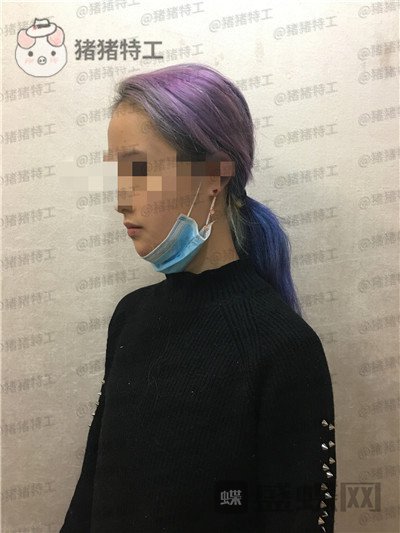 杭州艺星,万连壮,隆胸,案例,价格,