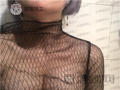 杭州艺星,万连壮,隆胸,案例,价格,