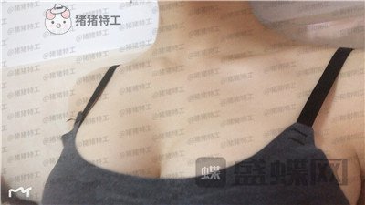 杭州艺星,万连壮,隆胸,案例,价格,