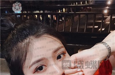 杭州艺星,杨连华,眼部手术,案例,价格,