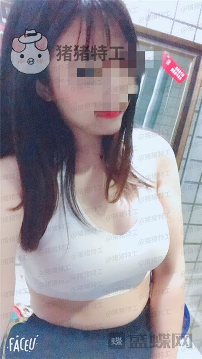 南京美贝尔,黄名斗,隆胸,案例,价格,
