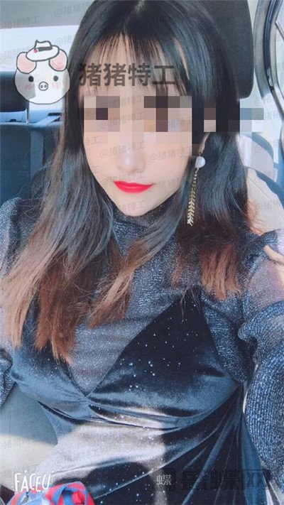 南京美贝尔,黄名斗,隆胸,案例,价格,