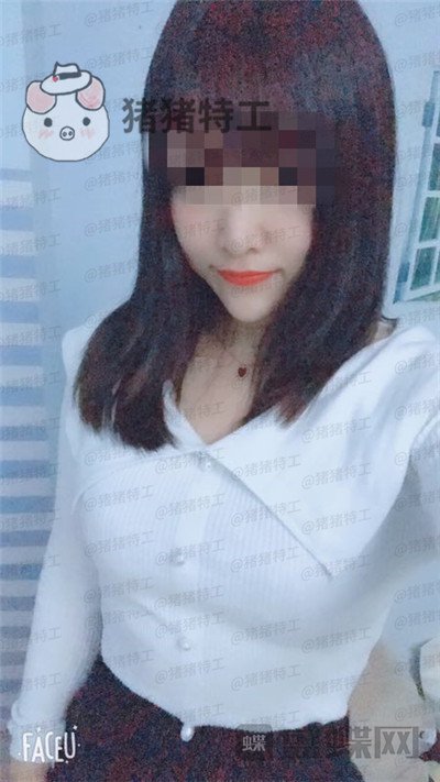 南京美贝尔,黄名斗,隆胸,案例,价格,