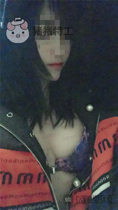 南京美贝尔,黄名斗,隆胸,案例,价格,