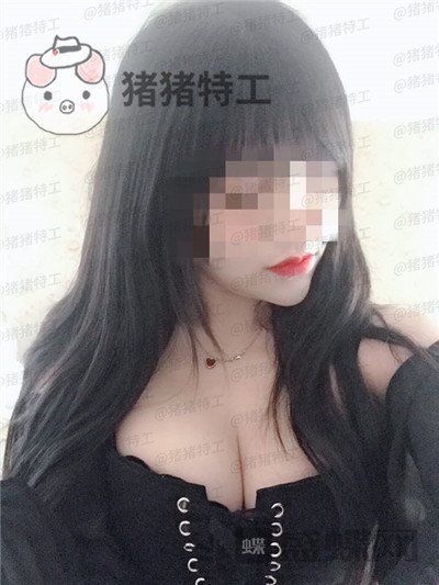 南京美贝尔,黄名斗,隆胸,案例,价格,