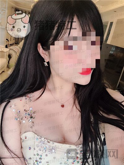 南京美贝尔,黄名斗,隆胸,案例,价格,