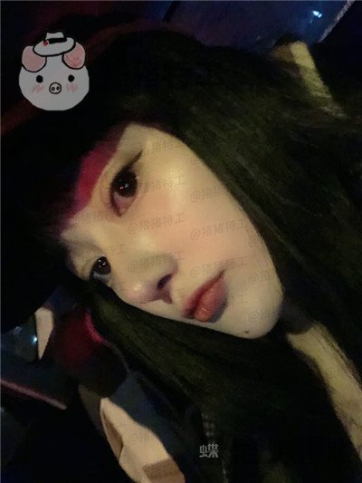 北京悦丽汇,姚然,鼻部手术,案例,价格,