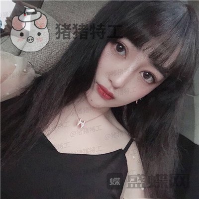 北京悦丽汇,姚然,鼻部手术,案例,价格,