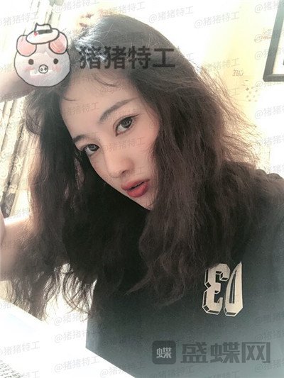 北京悦丽汇,姚然,鼻部手术,案例,价格,