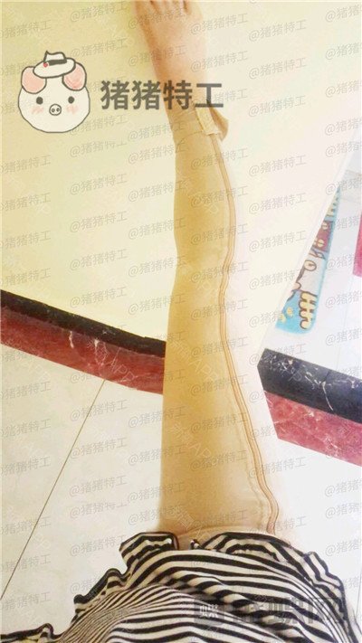成都西区医院,毛健清,吸脂,案例,价格,