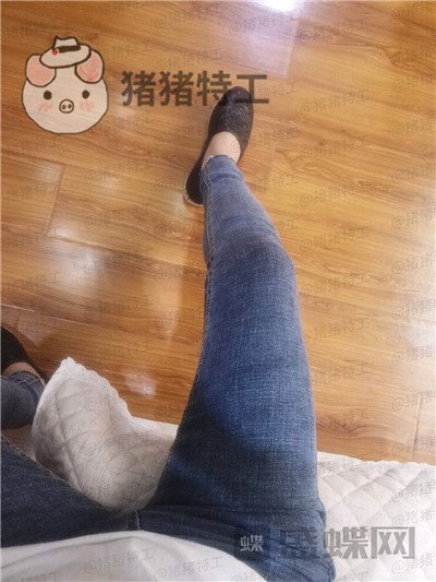 成都西区医院,毛健清,吸脂,案例,价格,