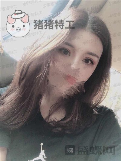 成都西区医院,车红昌,双眼皮,案例,价格,