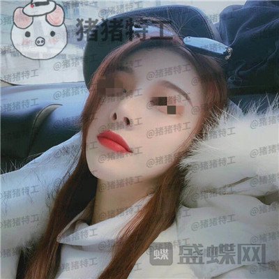 上海艺星,李建兵,隆鼻,案例,价格,