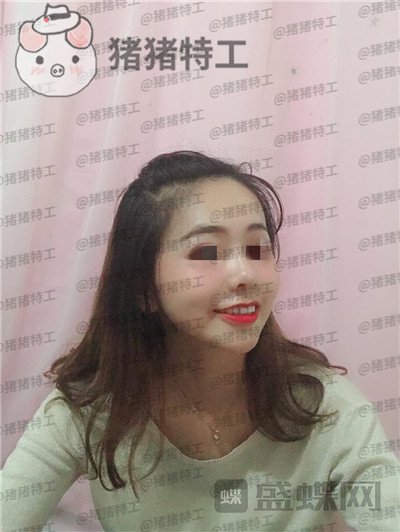 北京长虹,赵宏伟,隆鼻,案例,价格,
