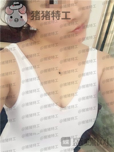 北京华悦府,王宁博,隆胸,案例,价格,