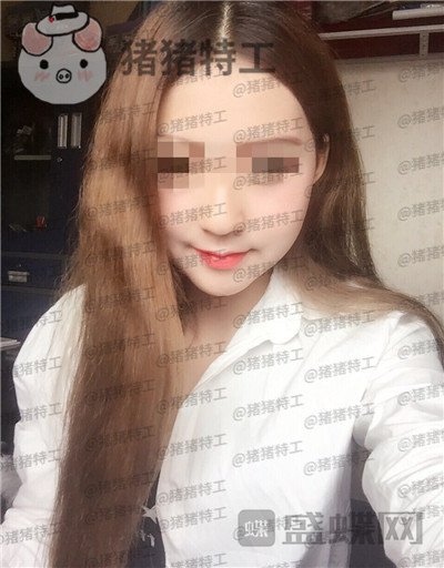 重庆华美,潘宝华,颧骨整形,案例,价格,