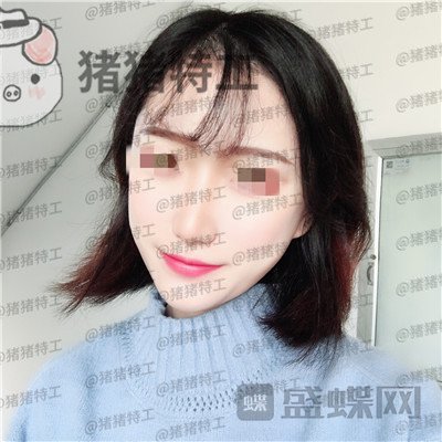 武汉华美,马行,鼻部手术,案例,价格,