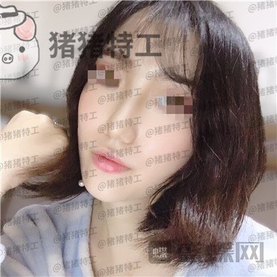 武汉华美,马行,鼻部手术,案例,价格,