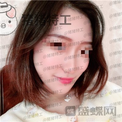 武汉华美,马行,鼻部手术,案例,价格,