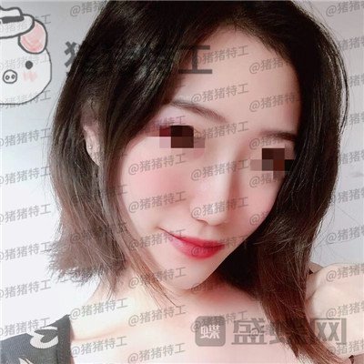 武汉华美,马行,鼻部手术,案例,价格,