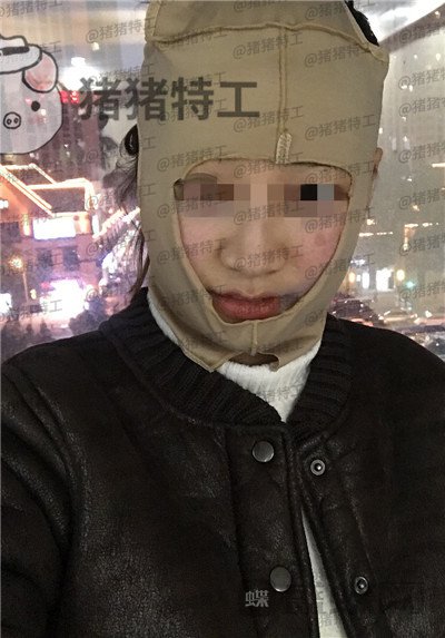 四川友谊,张立天,下颌角,磨骨,案例,价格,