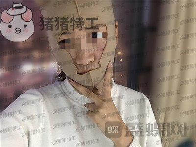 四川友谊,张立天,下颌角,磨骨,案例,价格,
