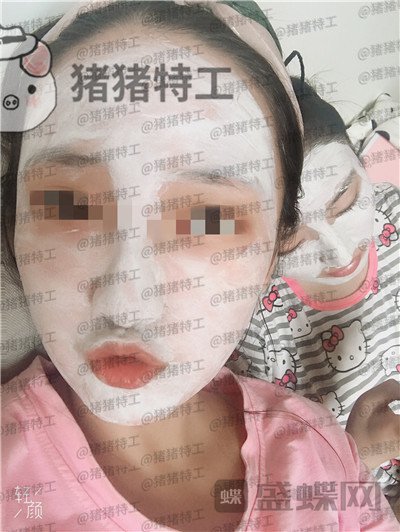 四川友谊,张立天,下颌角,磨骨,案例,价格,