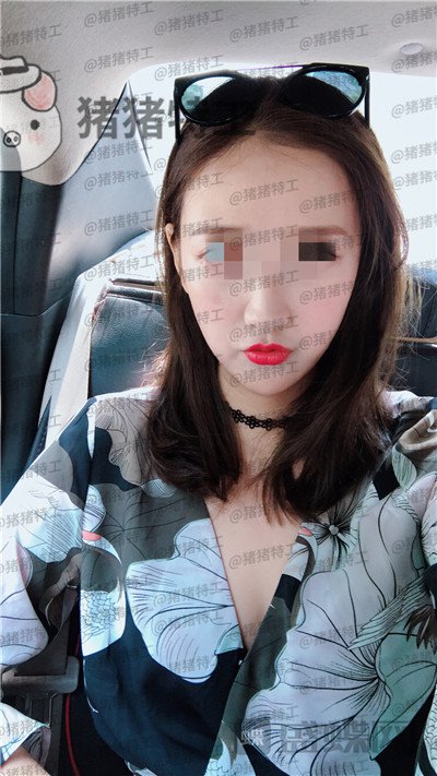 四川友谊,张立天,下颌角,磨骨,案例,价格,