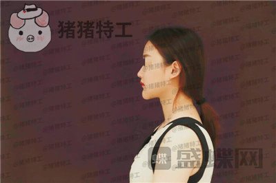 福州爱美尔,张胜利,鼻部手术,案例,价格,