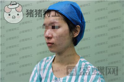 杭州同荣丽格,郭同荣,面部填充,案例,价格,