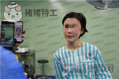 杭州同荣丽格,郭同荣,面部填充,案例,价格,