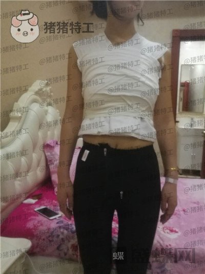 北京英煌,项力源,隆胸,案例,价格,