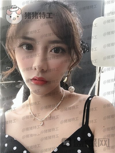 杭州伊琳,毛琪,面部填充,案例,价格,