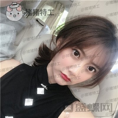 杭州伊琳,毛琪,面部填充,案例,价格,