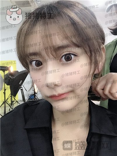 杭州伊琳,毛琪,面部填充,案例,价格,