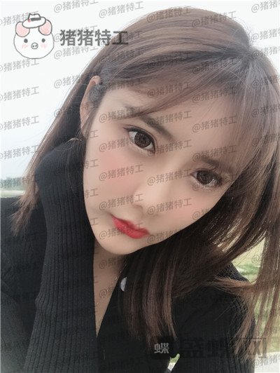 杭州伊琳,毛琪,面部填充,案例,价格,