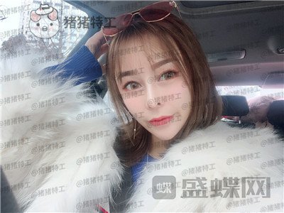 重庆铂生,杜亚旭,隆鼻,案例,价格,