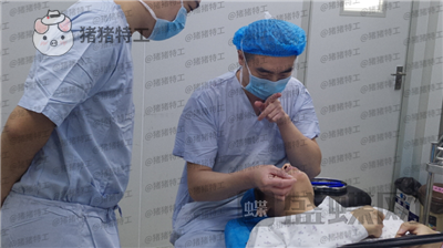 南京美贝尔,张永升,缩鼻翼,案例,价格,