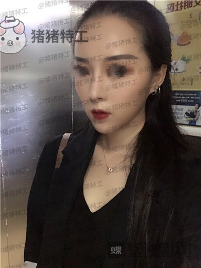 成都西区医院,车红昌,鼻部手术,案例,价格,