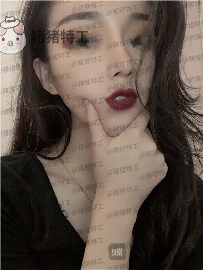 成都西区医院,车红昌,鼻部手术,案例,价格,