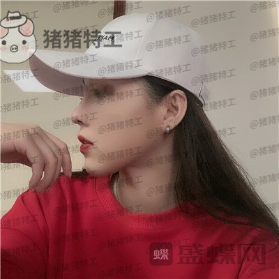 成都西区医院,车红昌,鼻部手术,案例,价格,