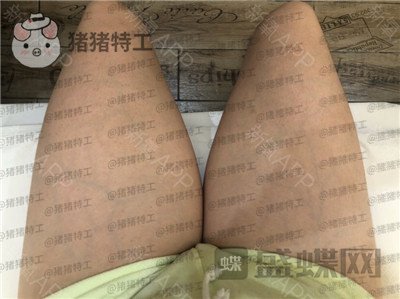 北京八大处,杨增杰,吸脂,案例,价格,