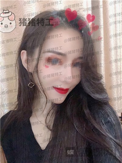 成都西区医院,车红昌,鼻部手术,案例,价格,