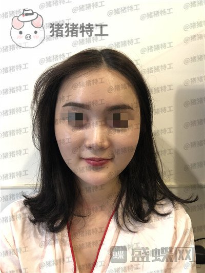 上海百达丽,原九院,沈国雄,隆鼻,案例,价格,