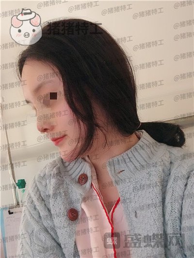 上海百达丽,原九院,沈国雄,隆鼻,案例,价格,
