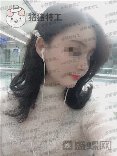 上海百达丽,原九院,沈国雄,隆鼻,案例,价格,