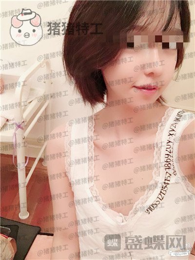 上海九院,周珍艳,隆胸,案例,价格,