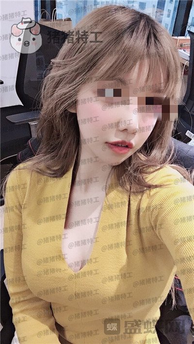 上海九院,周珍艳,隆胸,案例,价格,