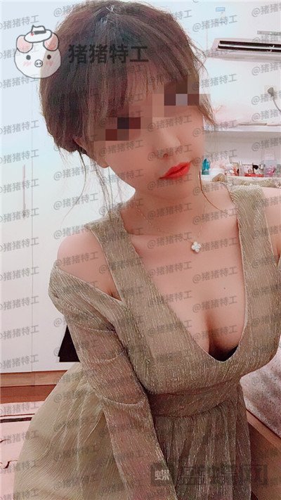 上海九院,周珍艳,隆胸,案例,价格,